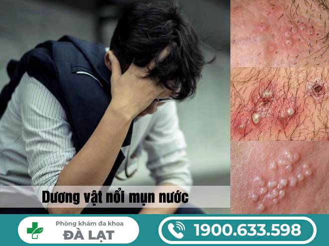 Hình ảnh minh họa